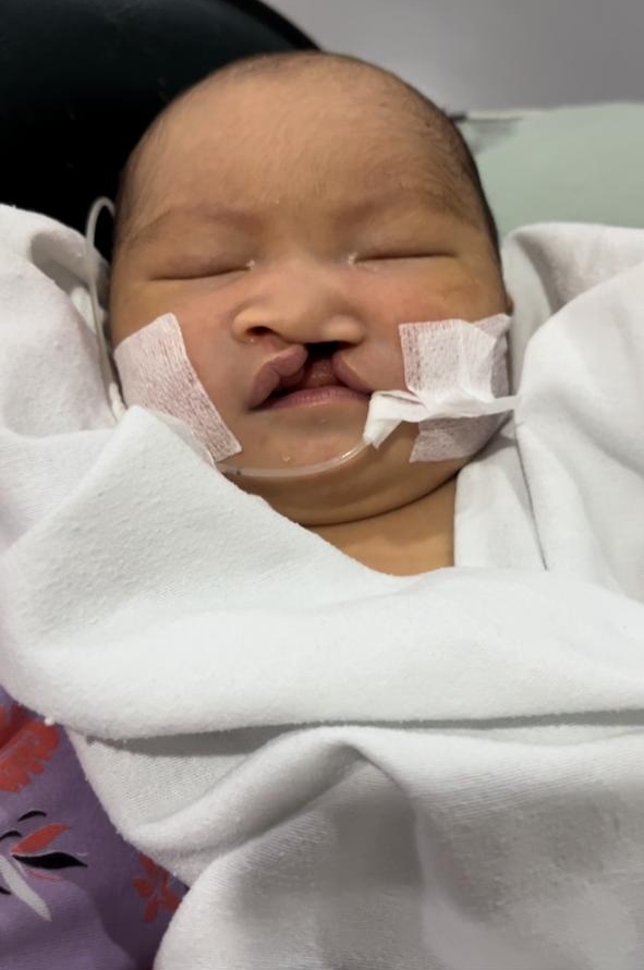 Kondisi Lidiya sebelum operasi